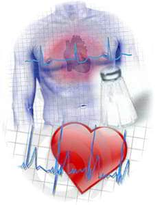 riesgo cardivascular