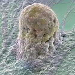 célula madre embrionaria