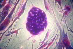 celulas madre