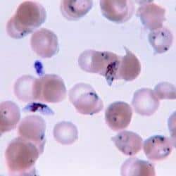 Plasmodium Malaria