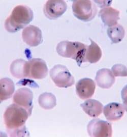 Plasmodium Malaria