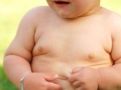 obesidad infantil