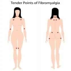 enfermedad de fibromialgia