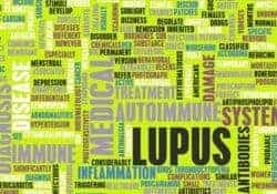 enfermedad de lupus