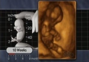 10 semanas embrión
