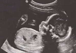 prueba ultrasonido en embarazada