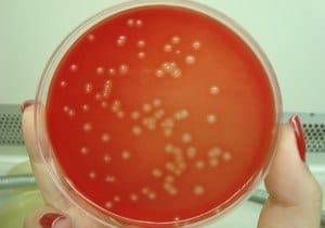 bacteria estreptococo