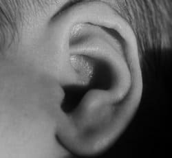 oreja y otitis