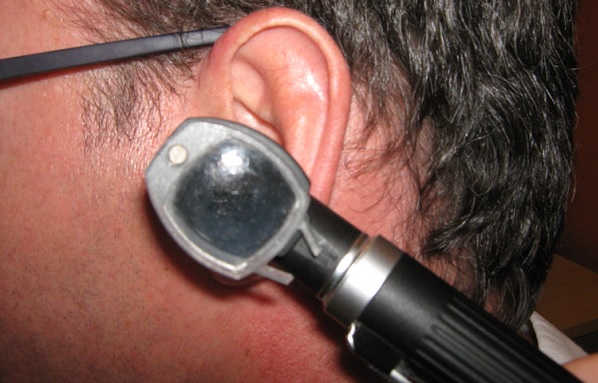 otoscopio en un oído