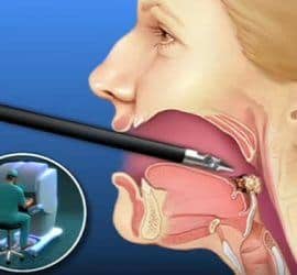cirugía en cáncer de boca y garganta