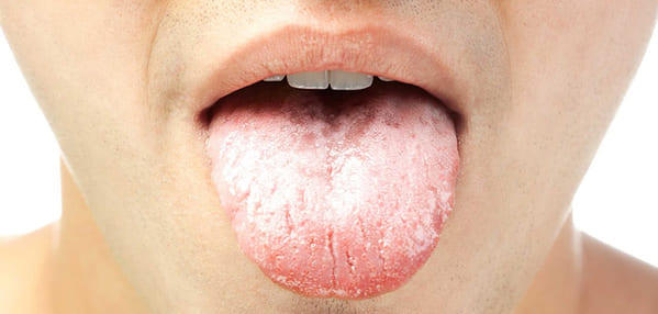 lengua color blanco