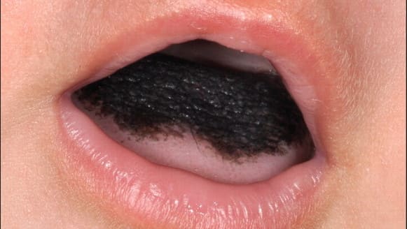 lengua color negra